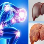 پژوهشگران مطرح کردند :اصلاح سبک زندگی، کلید غلبه بر کبد چرب
