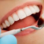کدام مواد غذایی از پوسیدگی دندان‌ها پیشگیری می‌کنند؟